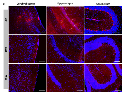 被包裹在含有NT-类脂质的LNP中的Cre重组酶乐成转移。。。。。。。大脑中的转染神经元呈红色高亮。。。。。。。