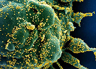 唾液检测新冠抗体新要领来了，，，，，获取效果仅需几小时！