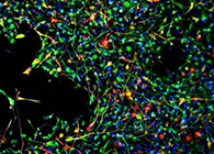 天下首创：药物将干细胞指导至受损部位，，，，，提高其愈合能力！