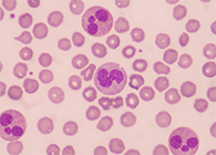 一种神秘颗粒被发明了！它能否成为败血症早筛标记物？？？？？