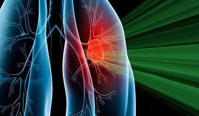 盛世泰科1类立异药物CGT-9475实现中美双报双批 | BG大游一站式临床宿世物医药研发效劳平台助力